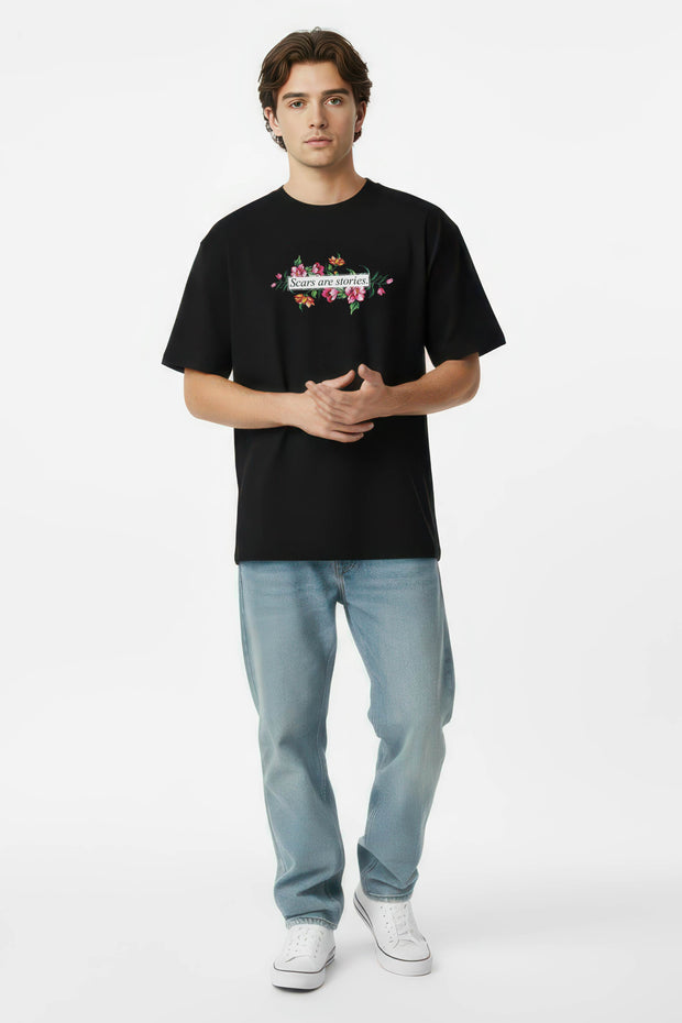 Scars are stories- Oversized Tshirt